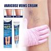 Крем SOL LORA Varicose Vein Repair Cream – снимает отеки ног и выпирающие вены