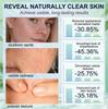 Salicylic Acid Pore Refining Cream 30g, Facial Skin Smoothing Cream, Refine Pores, Gentle Exfoliating Cream for Rough & Blemish-Prone Skin