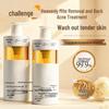 GHOST CALL BEAUTY Азелаиновая кислота Контроль акне и клещей Мусс для душа