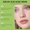 Азелаиновый крем 14%, Азелаиновая сыворотка с третиноином, Сыворотка для лица от прыщей и акне, Азелаиновый крем для ухода за лицом, Кожа с недостатками