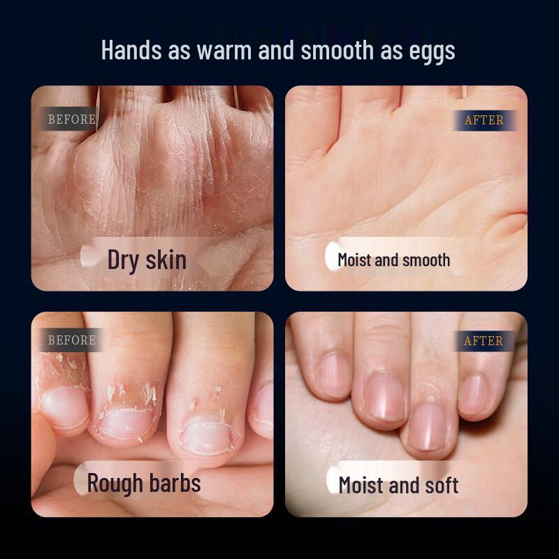 DETE Caviar Extract Moisturizing Hand Cream 4-Pack