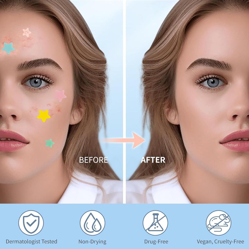 Патчи от прыщей для лица, Гидроколлоидные патчи от акне, Милые наклейки в виде звезд для прыщей, Цветные точечные наклейки с маслом чайного дерева, салициловой кислотой и маслом цики | 28 шт.