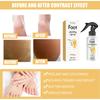 EELHOE Foot Peeling Spray Natural Orange Essence Pedicure Hands Dead Skin Exfoliator Mask Whiten Baby Foot Care Tool