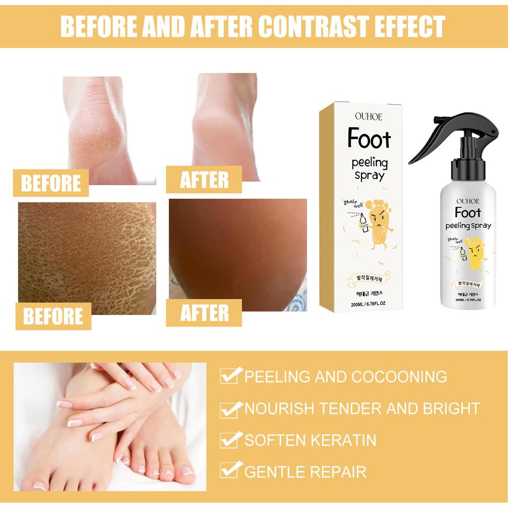 EELHOE Foot Peeling Spray Natural Orange Essence Pedicure Hands Dead Skin Exfoliator Mask Whiten Baby Foot Care Tool