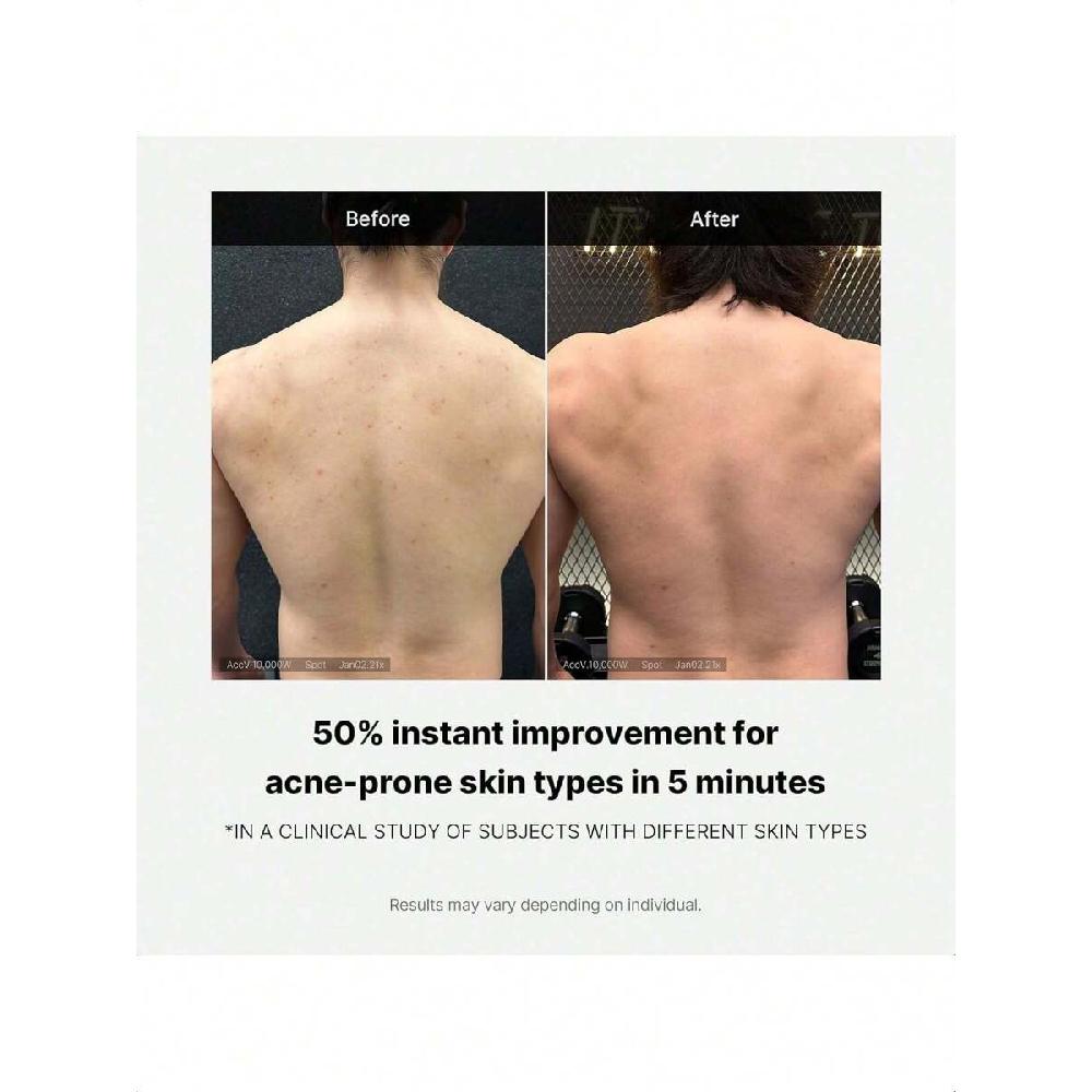 Medicube Red Acne Body Wash 400g Low Ph And Hydrating Cleanser With Salicylic Acid, Lactic Acid, Niacinamide And Hyaluronic Acid Suitable