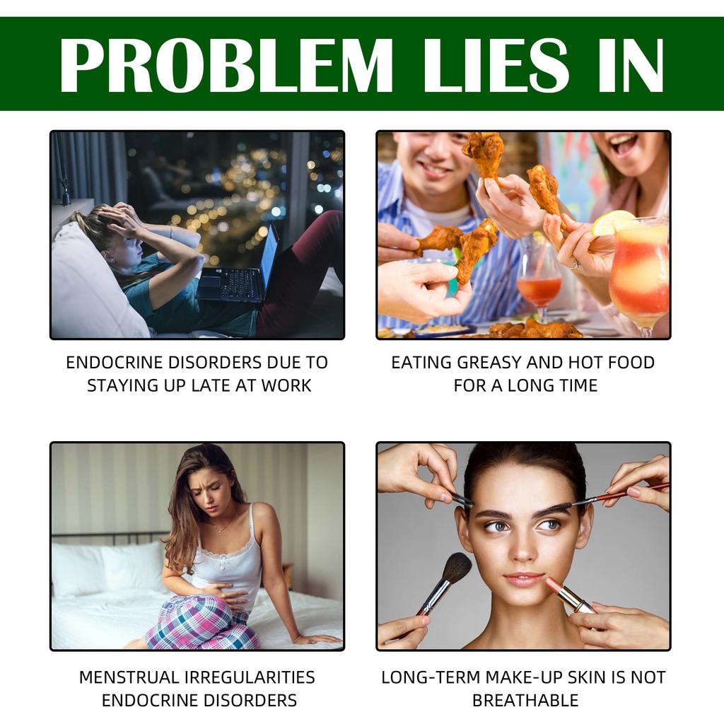 Пластыри от прыщей от прыщей Невидимые гидроколлоидные пластыри от прыщей с маслом чайного дерева и маслом календулы, пластыри для заживления пятен от прыщей, патчи от прыщей для лица