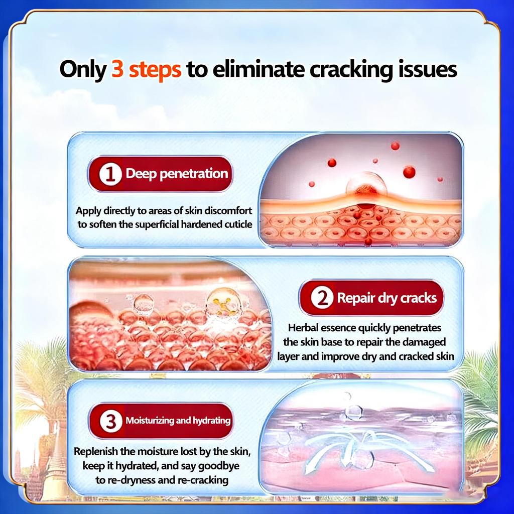 Крем для ног против сухости и трещин, Предотвращающий растрескивание, Восстанавливающий крем, Сухость, Пятки, Отшелушивающий, Удаляет омертвевшую кожу, Восстанавливающий крем, Традиционная китайская косметика, пластырь