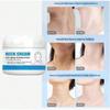 Neck Wrinkle Cream Moisturizes the Neck, Desalinates the Fine Neck Wrinkles, Protects and Lifts the Skin, and Beautifies the Neck Cream