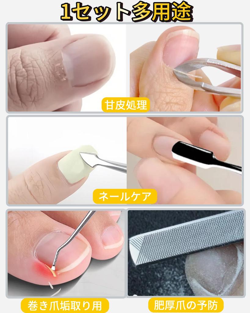KERURU Cuticle Care Set of Includes Nail Nail Cuticle Nail Dirt Nail and Cuticle Made of Stainless for Ingrown Nail Gel Nail Hangnail and Nail Care