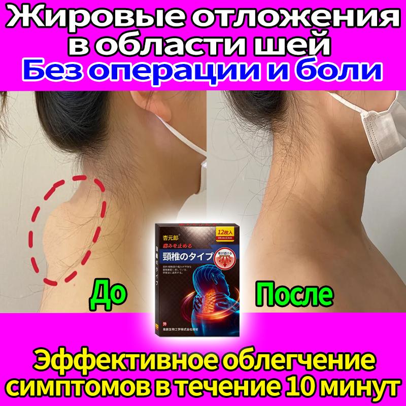 Patch for Reducing Fatty Deposits On the Neck