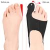 Корректор косточки большого пальца ноги, износостойкий, регулируемый дизайн, облегчение боли, коррекция косточки большого пальца ноги, выпрямитель