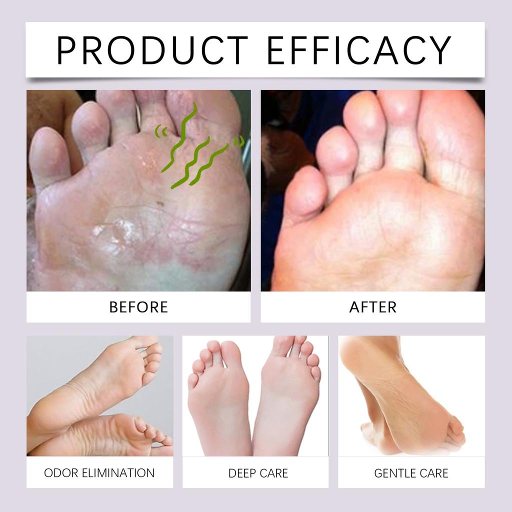 Спрей-антиперспирант, Спрей для удаления запаха ног и антиперспирант, Спрей для ухода за ногами, 30 мл