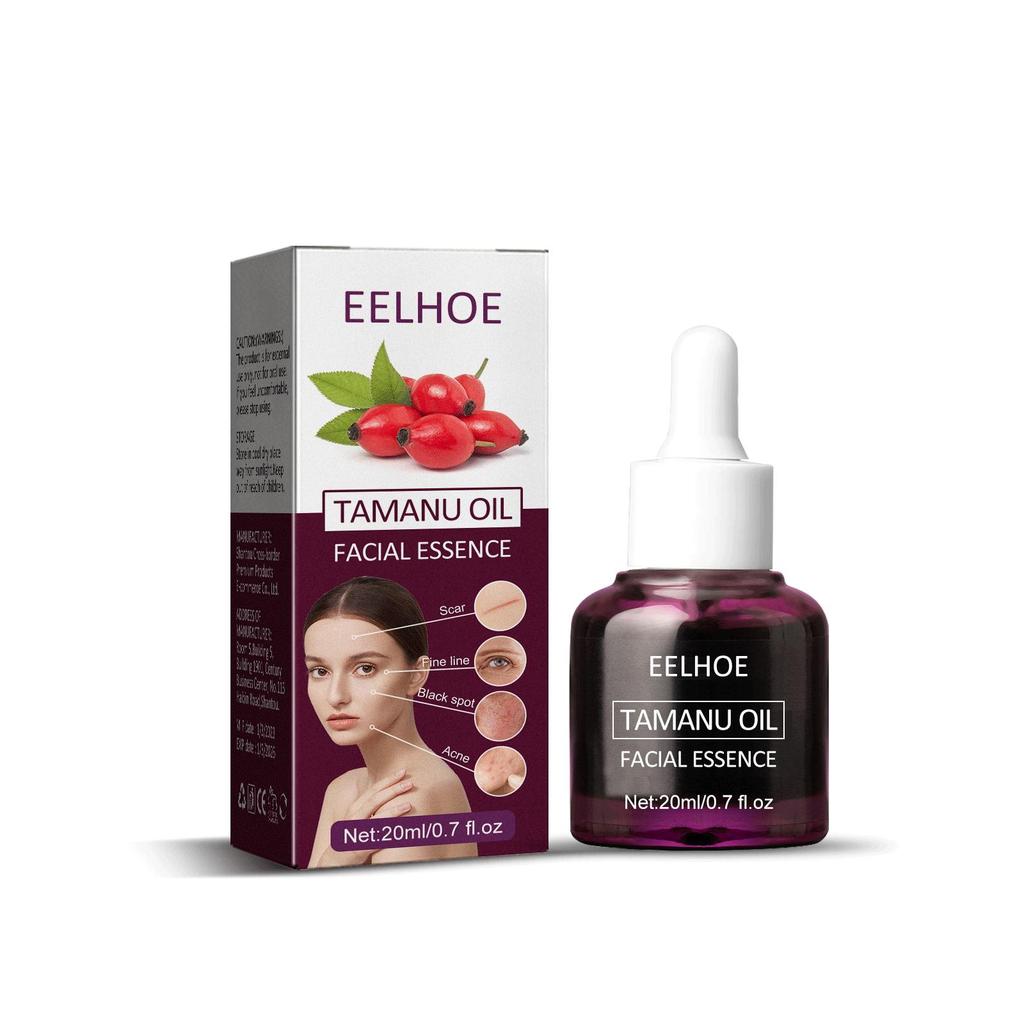 EELHOE Масло для лица «Бегония» уменьшает следы от прыщей, осветляет морщины, увлажняет и укрепляет кожу. Эфирное масло