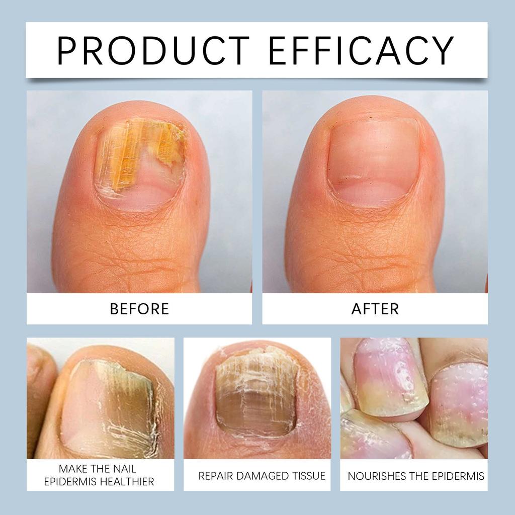 Крем для ухода за ногтями, Мягкий восстанавливающий, очищающий и питающий ногти, снимающий блеск, неприятный крем для ухода за ногтями