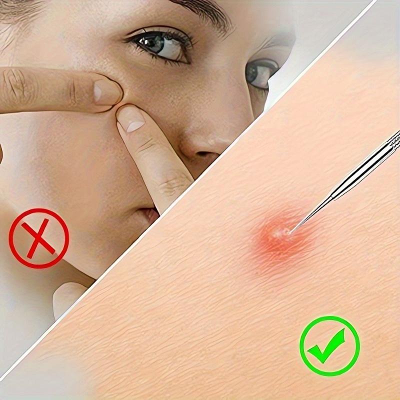 Набор игл для удаления угрей, инструмент для удаления черных точек, набор для удаления угрей, инструмент для удаления угрей на носу и лице с коробкой для устранения пятен