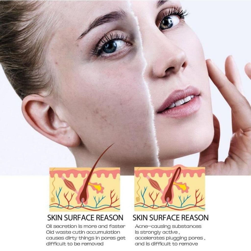 Vitamin C Retinol Firming Serum, Firming Lifting Essence, Softens Skin, Improves Elasticity,  Smoothes Wrinkles, Skin Care Face Serum For Women