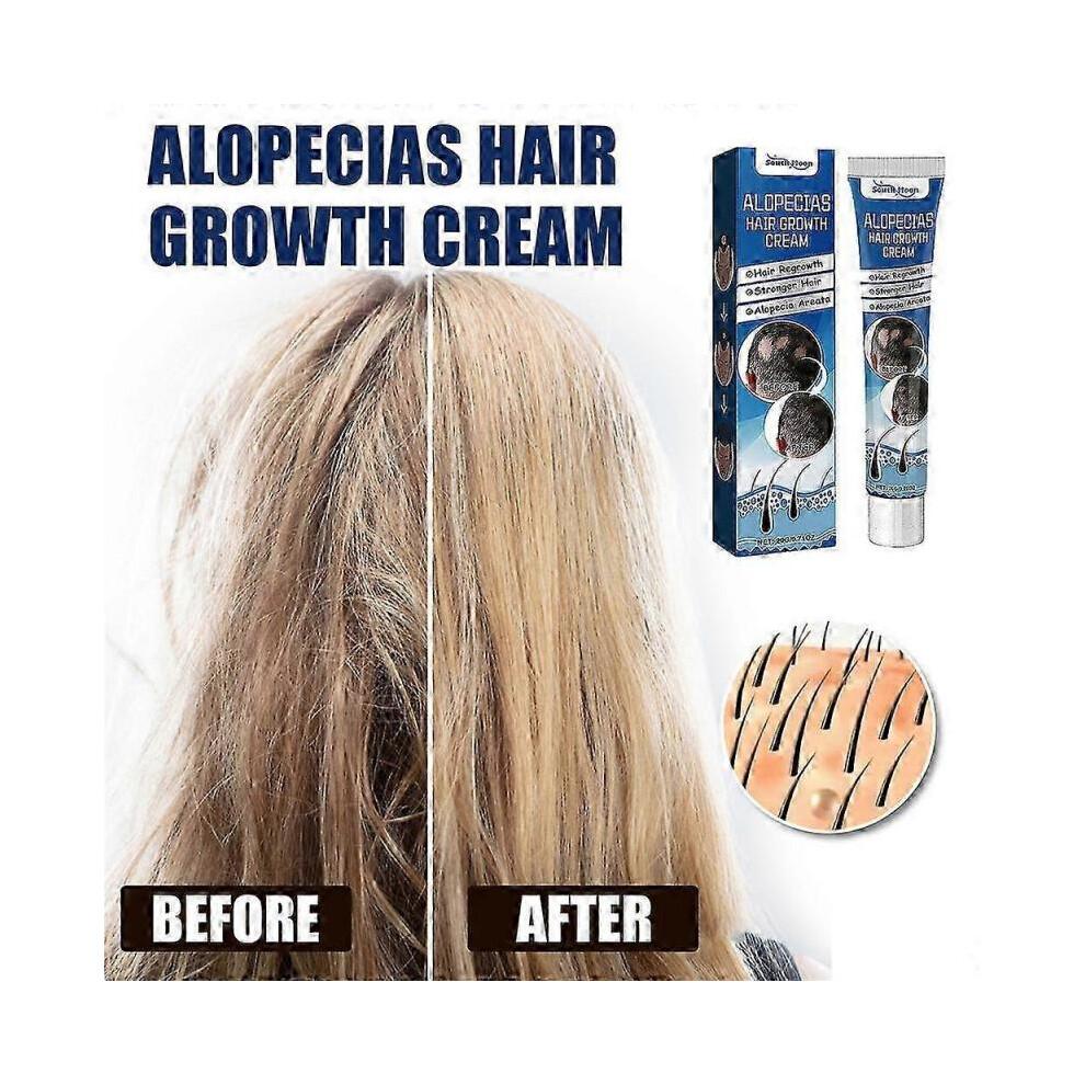 (2 pcs)1-3x New Alopecia Cream Growing Alopecia Baldness Regrowth 20g
