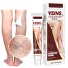 Varicose Vein Cream,v K Cream Vein Cream For Legs Varicose Veins For Legs 20g