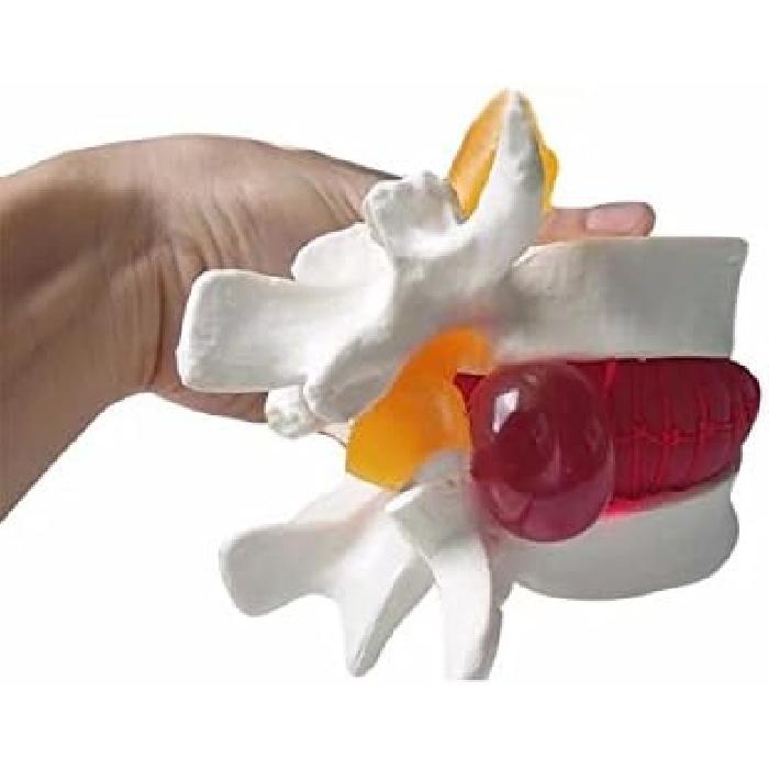 BoNew-Oral 1:1.5 Anatomical Human Lumbar Vertebrae Degenerative Lumbar Human Spine Model White Color