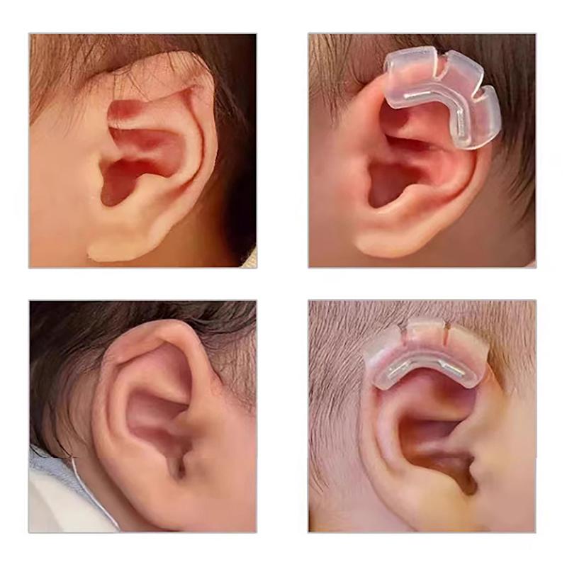 1Pcs Baby Auricle Support External Auricle Corrector Protruding Baby Ear Corrector Baby External Auricle Corrector Ear Pads