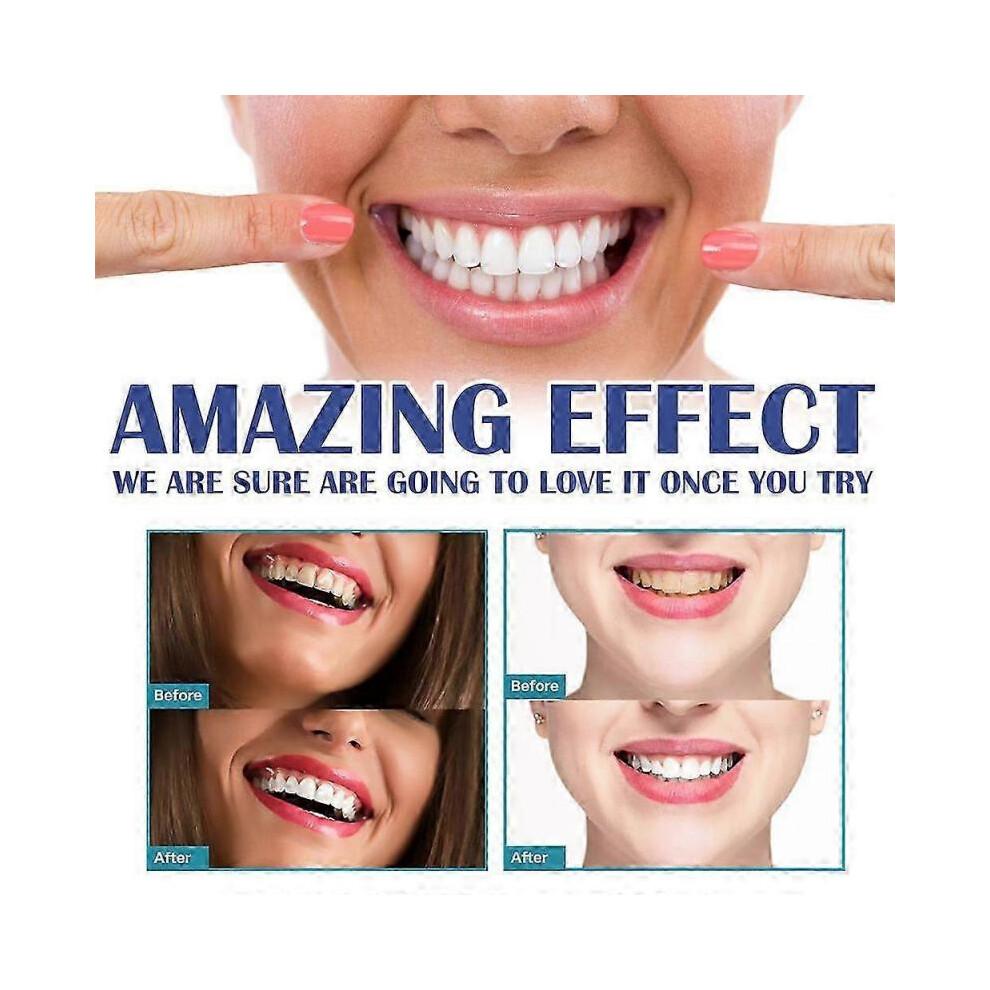 3Pcs Gum Therapy Gel Gum Instant Soothing Gels for Sensitive Teeth Pen 4ml