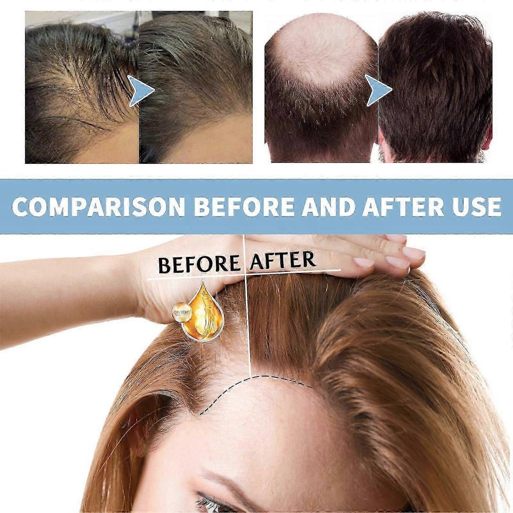 Dense Foam Shampoo for Thicker, Fuller Hair - Natural Nourishing & Scalp Care