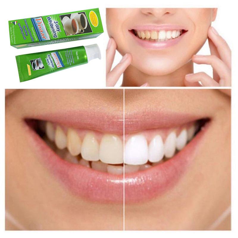 Disaar 100g/pc Exquisite Girl 3 Day Whitening Toothpaste Softening Stubborn Teeth Stains Toothpastes Micro-Heat Techremoves Touch Stain