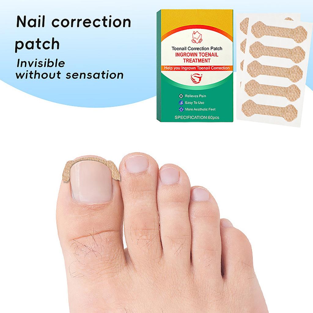 60PCS Nail Correction Patch Breathable Ingrown Toenail Sticker Nail Care Strips Customs Name: Plastic Patch
