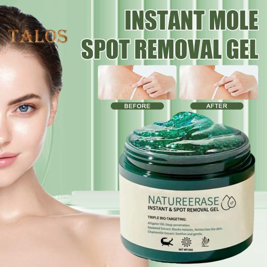Гель-корректор для мгновенного удаления родинок и пятен, крем для всех типов кожи, натуральные экстракты, 50 г, увлажняющий гель для удаления темных пятен на теле, восстановление кожи, уменьшение