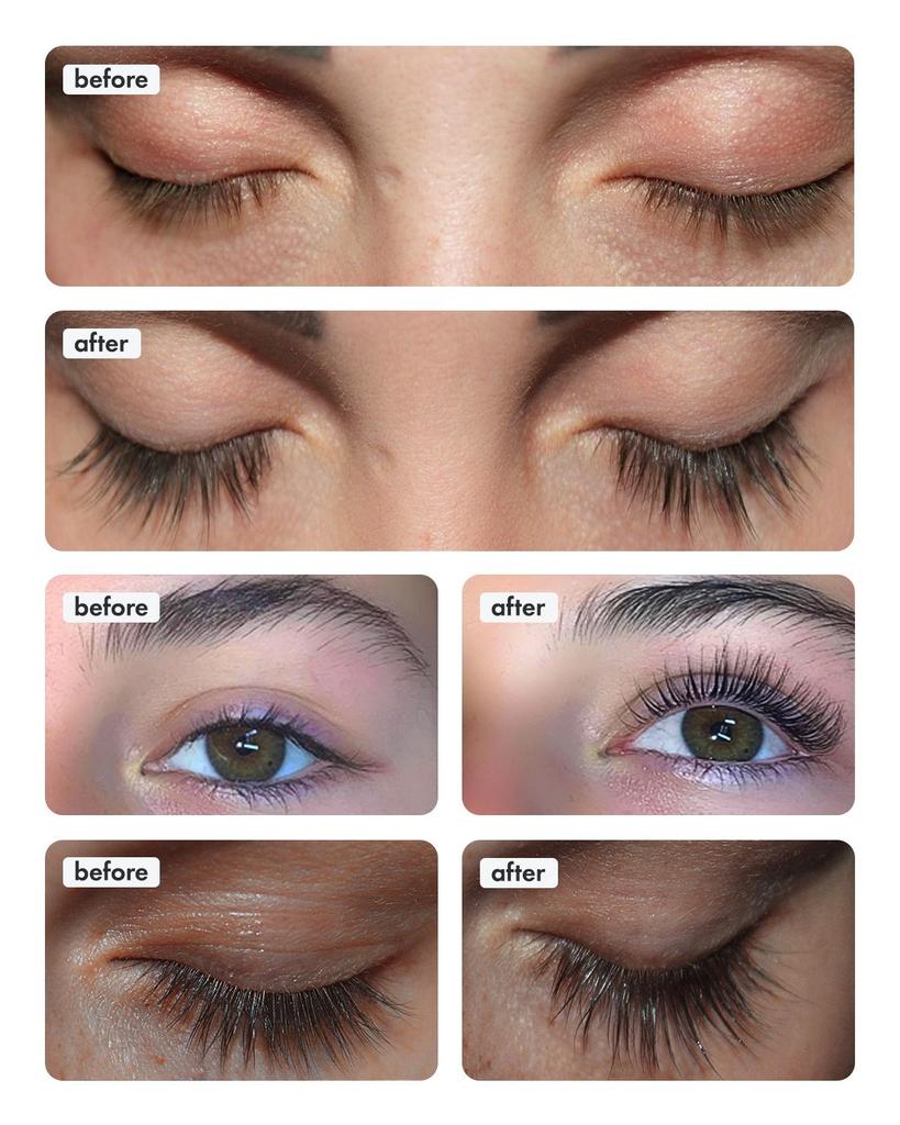 Toplash Сыворотка для роста ресниц XL