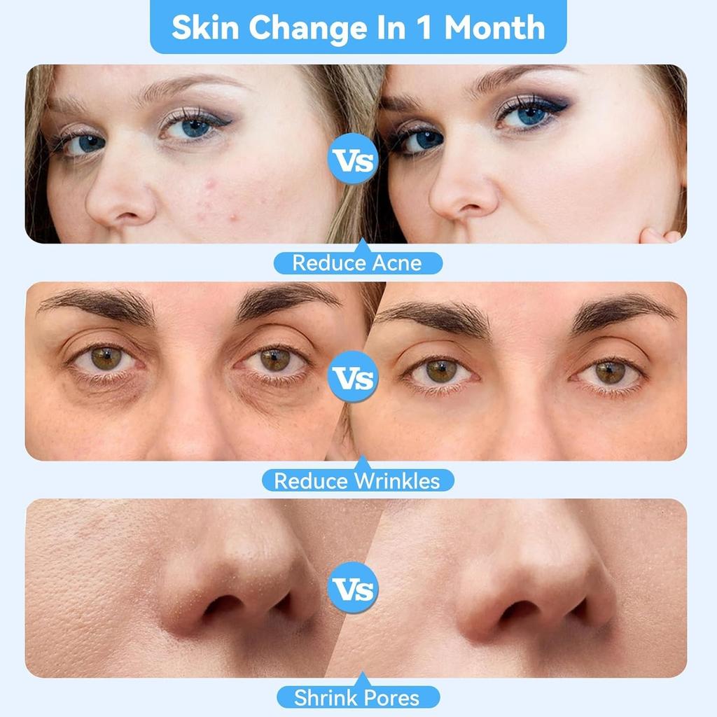 Аппарат для алмазной микродермабразии лица SC864, профессиональный инструмент для глубокой очистки лица, домашнее оборудование для ухода за кожей лица