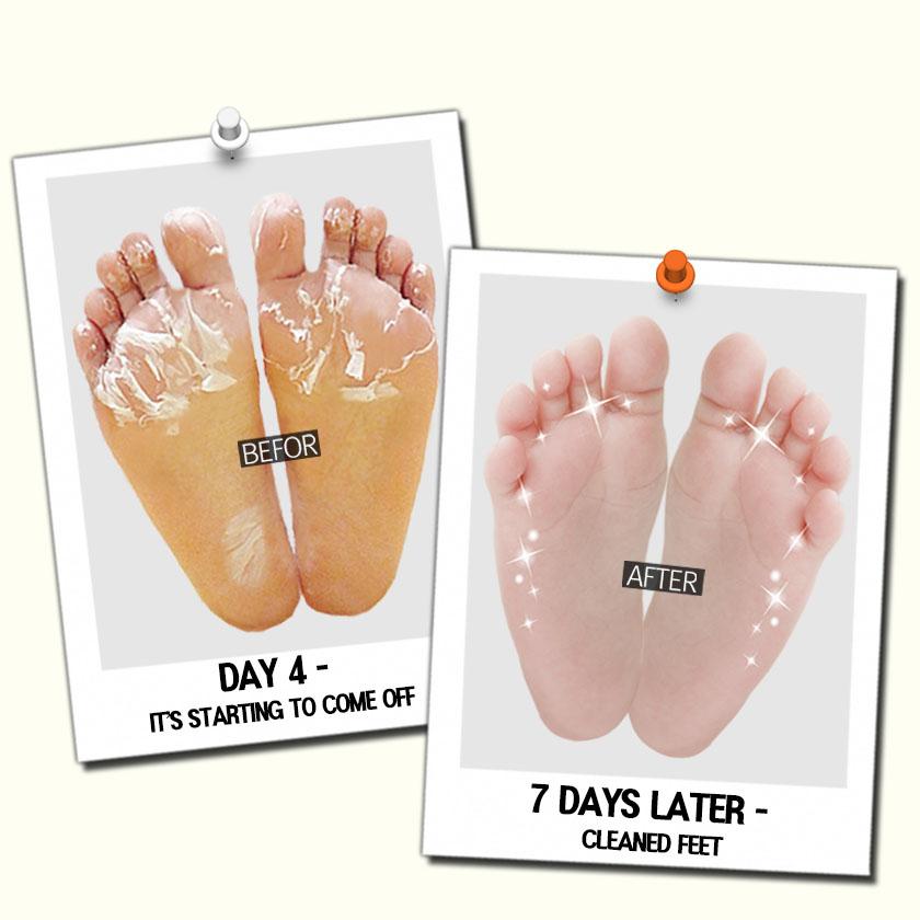 [КОРЕЯ АУТЕНТИЧНЫЙ] [DOUBLE&ZERO] Маска для ног с двойным эффектом 1 шт. 3 шт. 5 шт.