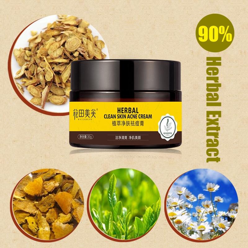 Крем с травами, крем против шрамов от прыщей, крем для лица, контроль жирности, восстанавливающий крем от прыщей, уход за лицом, отбеливающий крем, 30 г