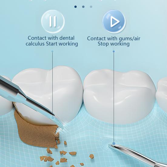 Ультразвуковой очиститель зубного налета Портативный электрический стоматологический скалер USB-перезаряжаемый прибор для удаления зубного камня Устранитель зубного камня Инструменты для чистки зубов
