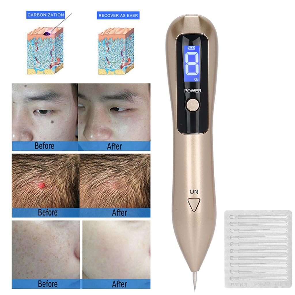 Ручка для удаления родинок 9 скоростей Регулировка Удаление темных пятен веснушек с синим светом