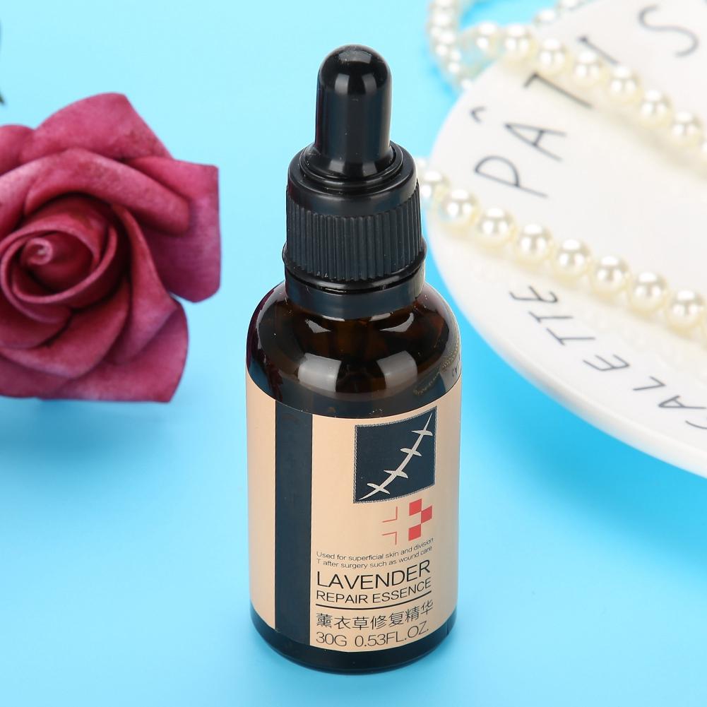 Эссенция для лечения угревой сыпи и рубцов Lavender Scar Acne Repair Essence Essence Stretch Marks Treatment Skin Repair Liquid