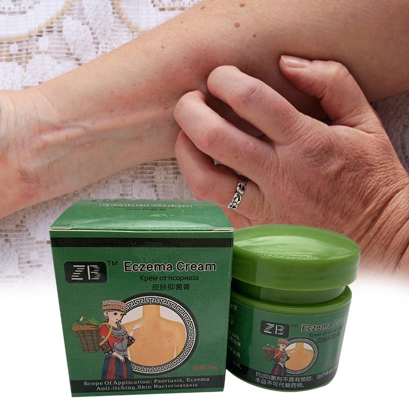 Уход за телом Уход за кожей Крем для ухода за кожей тела против зуда на основе китайских трав