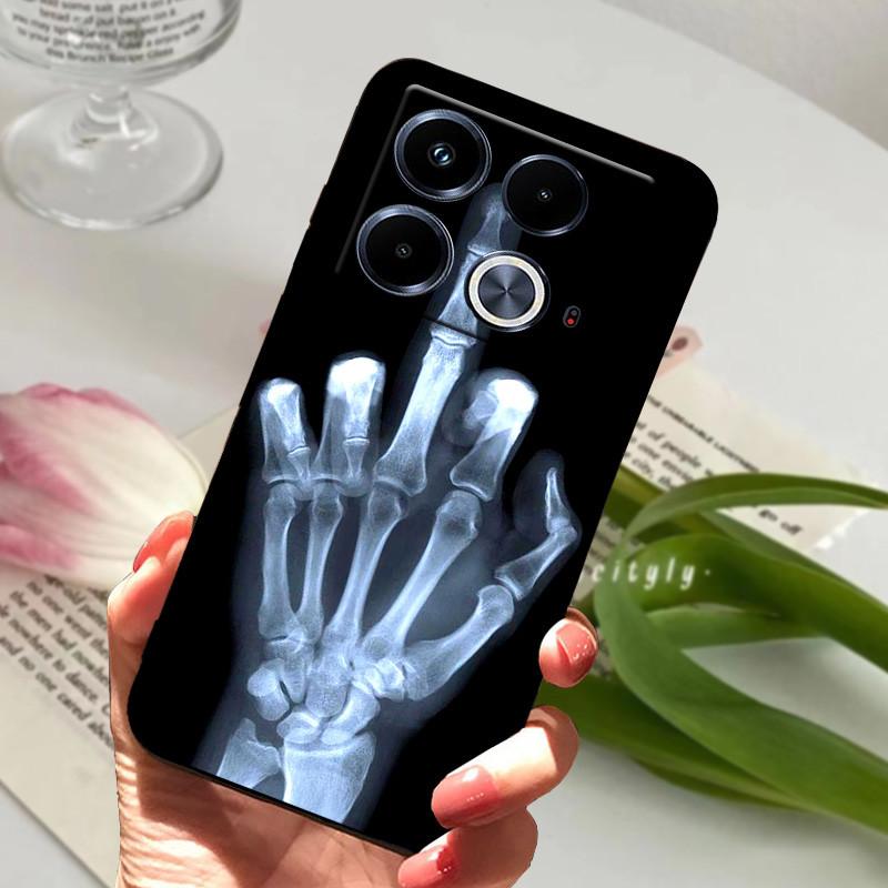 Чехол для Infinix Note 40 из мягкого силиконового ТПУ с рисунком животных, защитный чехол для Infinix Note 40 Pro 4G 5G 40 Pro Plus.
