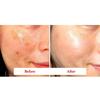 DERMA FACTORY Транексамовая кислота 6% крем 30мл