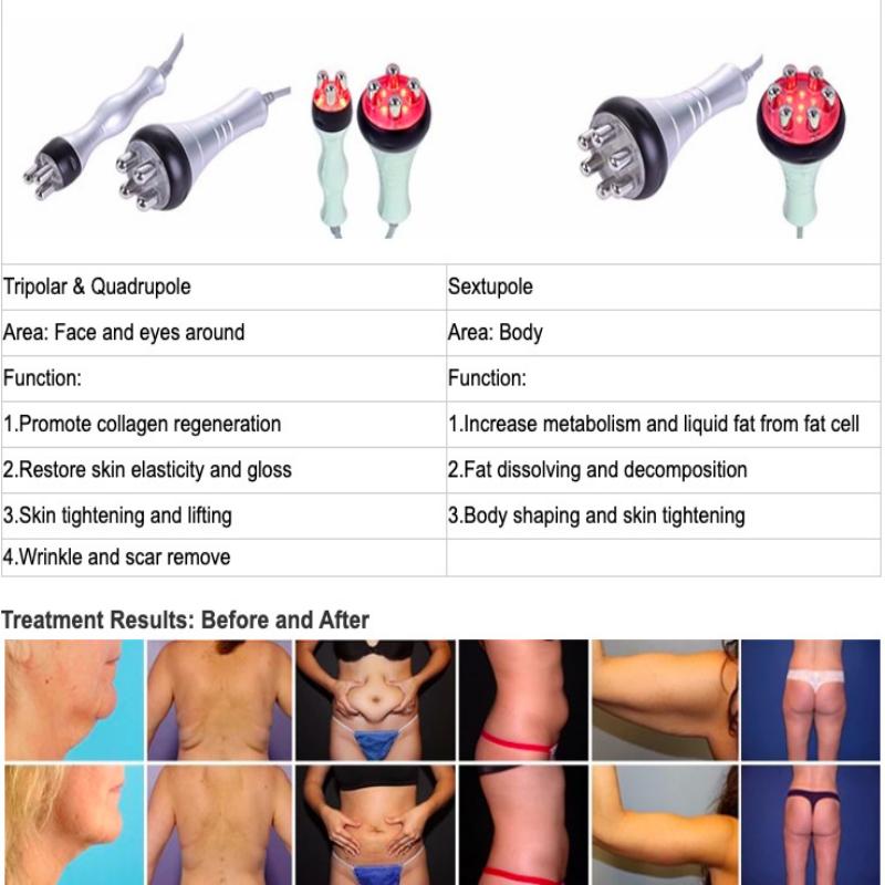 5 In 1 Vacuum Ultrasonic Cavitation Radio Frequency Multipolar RF Body Slimming Machine Skin Lifting Tighten Anti-Wrinkle Device