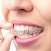 3 Pack Teeth Whitening Gel With Braces Shaping Invisible Braces Teeth Whitening Tool, Clear
