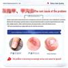 Que Yi Shi Jia Antifungal Nail Repair Solution