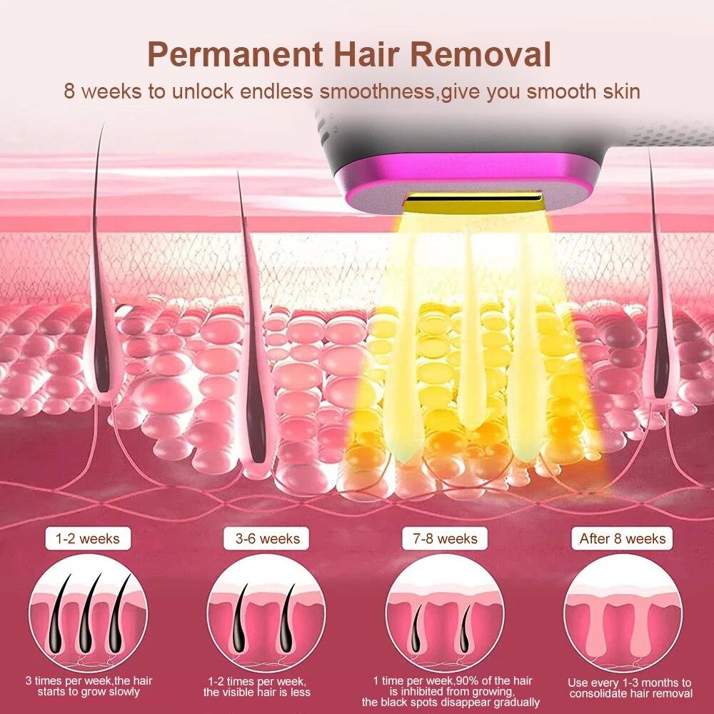 Устройство для удаления волос с интенсивным импульсом, устройство для постоянного удаления волос, безболезненное устройство для удаления волос, устройство для фотонной эпиляции для салонов красоты/дома