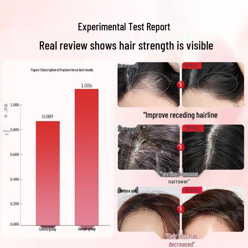 BaWang Women's Anti-Hair Loss Shampoo