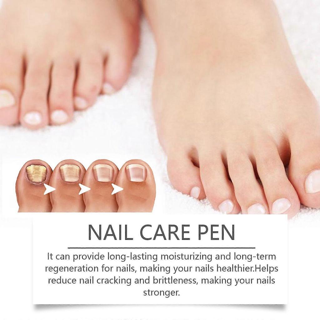 Ximonth Onychomycosis Care Pen, Hand And Foot Onychomycosis Nutrition Care Pen, Bright Nail Thick Toe Care Pen