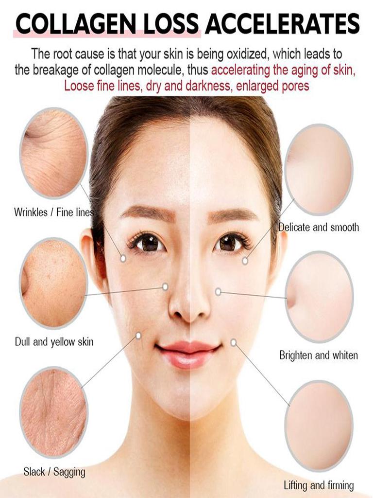 Whitening Freckle Cream Effective Remove Melasma Dark Spots Cream Fade  Moisturize Brighten Smooth Beauty Face Skin Care