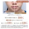 YA-MAN Facial Beauty Device Photo Plus Deep Lift Power Booster Pad Set of 2 Lift Up Pore Clean Hydrate YJFA1T Bronze