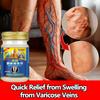 Varicose Veins Cream - Relief for Leg Pain, Heavy Legs & Swelling, Works In 3 Days, Natural Formula 55g
