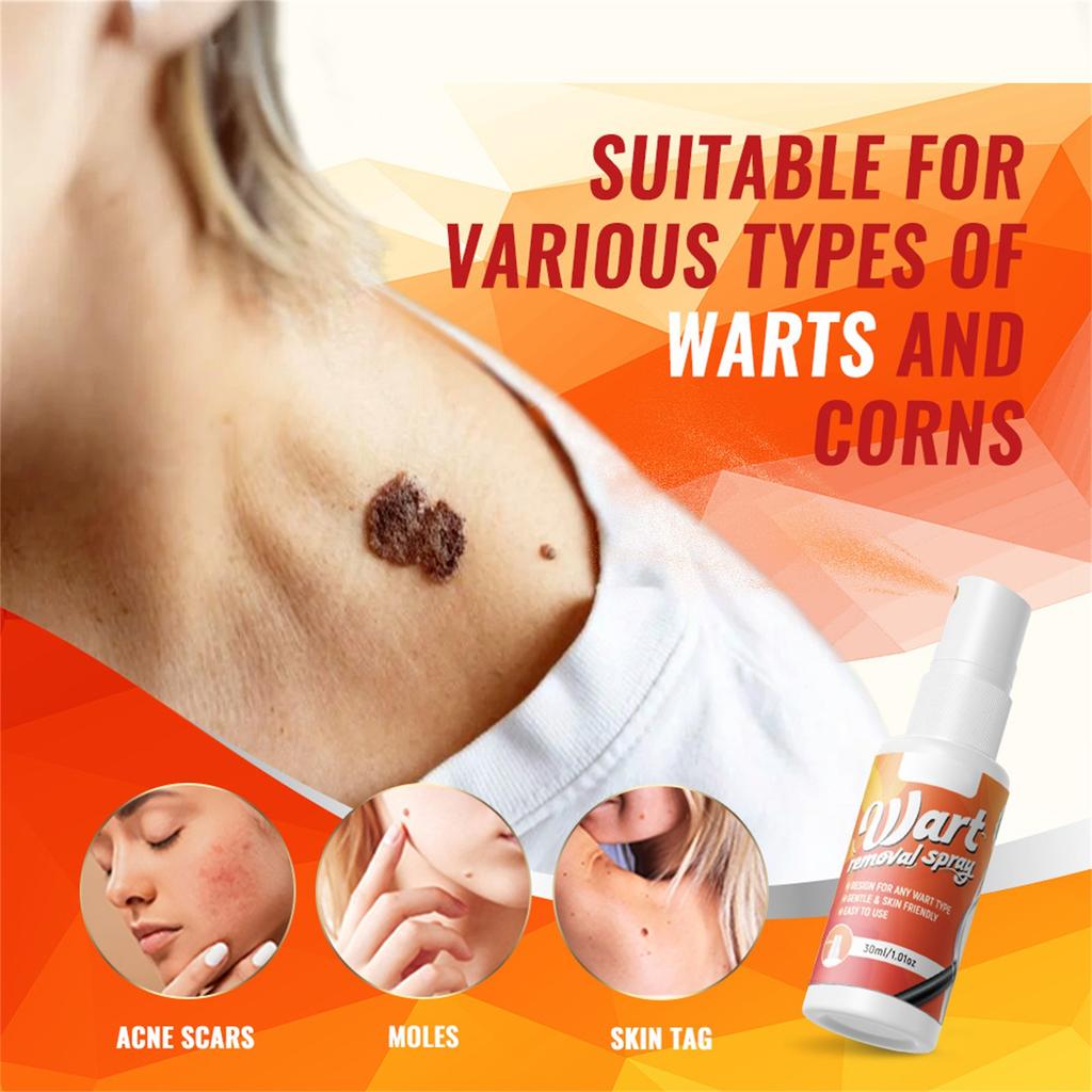 Спрей для удаления кожи 30 мл, Быстродействующий, Длительное облегчение, Растительный спрей для удаления кожи