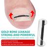 Titanium Alloy Toenail Correction Wire Ingrown Nail Treatment Device Stickers Silicone Tool Foot Care Accessories Daily Use